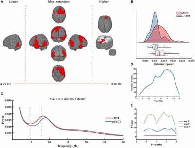 The effects of white matter hyperintensities on MEG power spectra in population with mild cognitive impairment